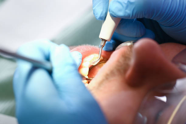 Best Weekend Emergency Dentist in Bonner Springs, KS